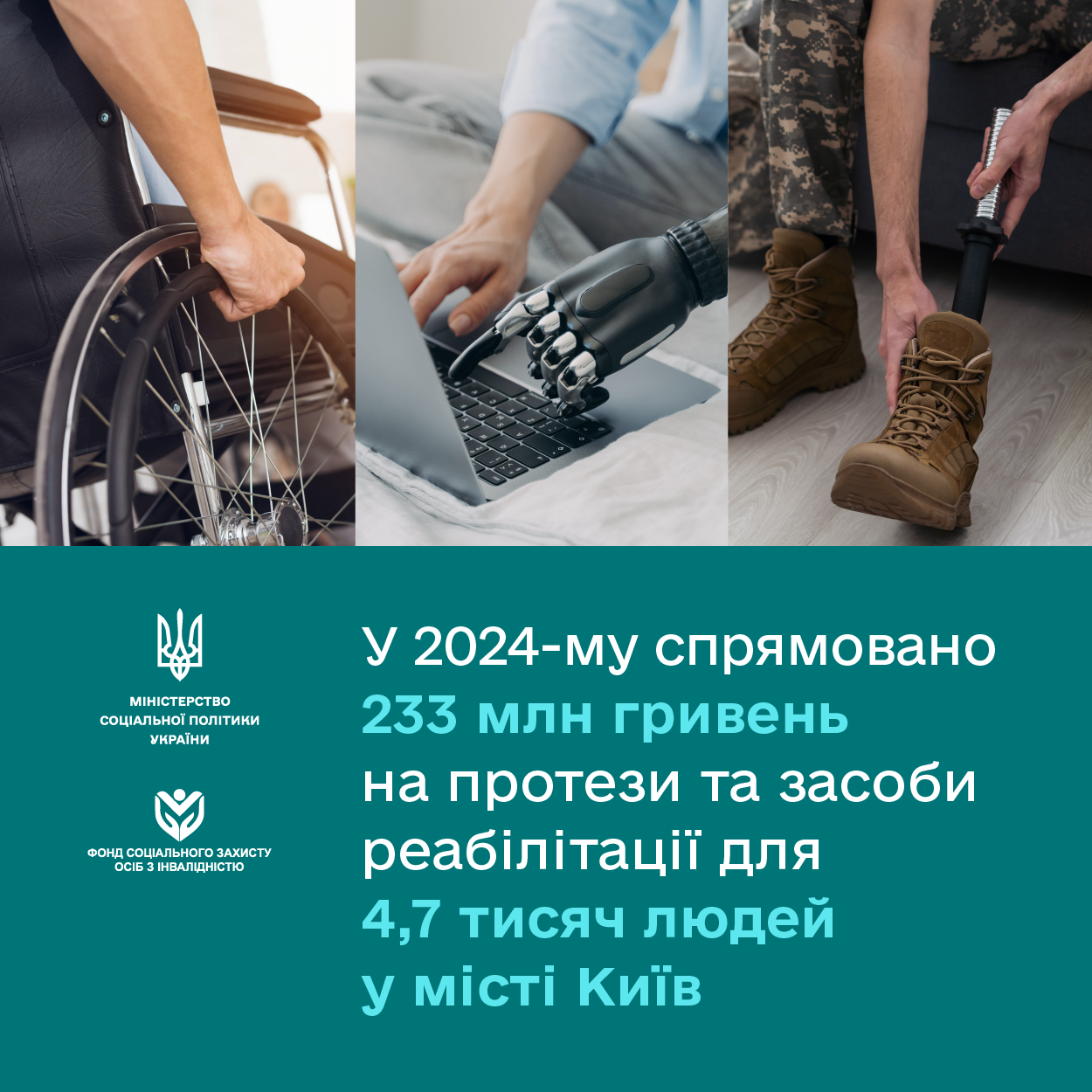 Протезування в Україні — безоплатне. Держава гарантує отримання якісних протезів та інших засобів реабілітації, покриває їх ремонт, заміну та обслуговування